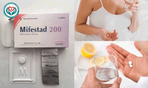 Bác sĩ hướng dẫn cách ngậm thuốc Misoprostol