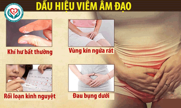 Nhận biết triệu chứng viêm âm đạo thường gặp