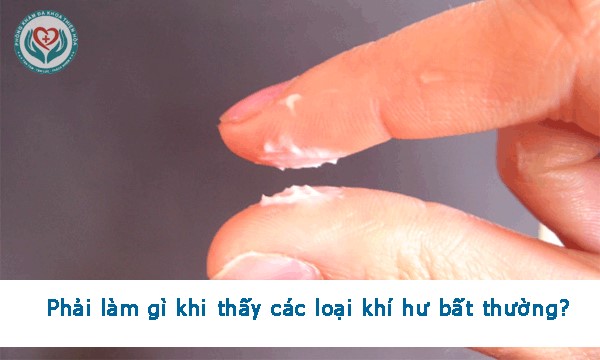 Phải làm gì khi thấy dấu hiệu các loại khí hư bất thường?