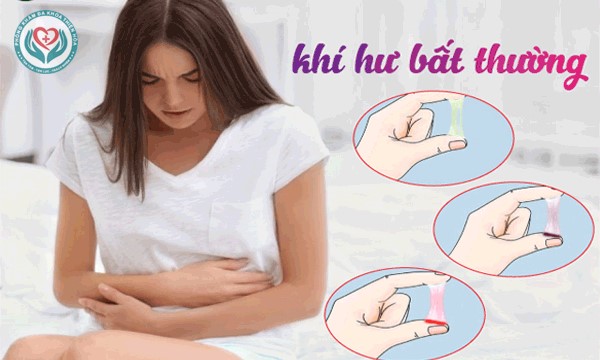 Quy trình khám và chữa trị khí hư thất thường hiệu quả tại Đa khoa Bắc Việt