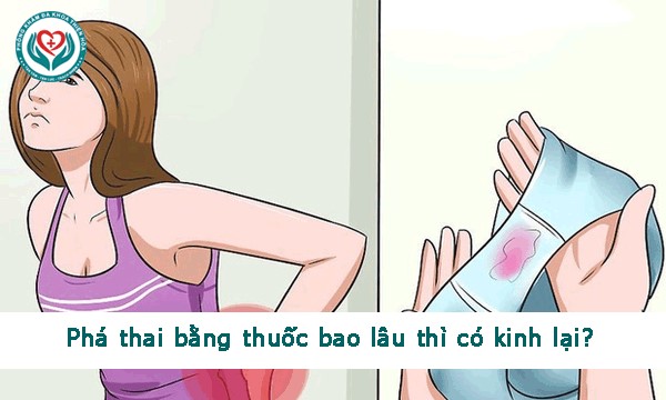 Phá thai bằng thuốc bao lâu thì có kinh lại?