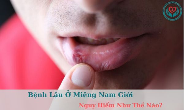 Bệnh lậu ở miệng nam giới nguy hiểm như thế nào?