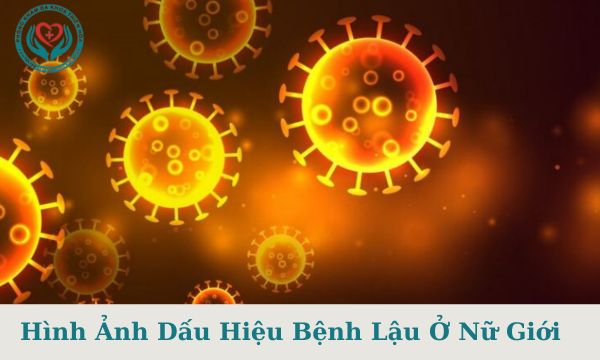 hình ảnh dấu hiệu bệnh lậu ở nữ giới