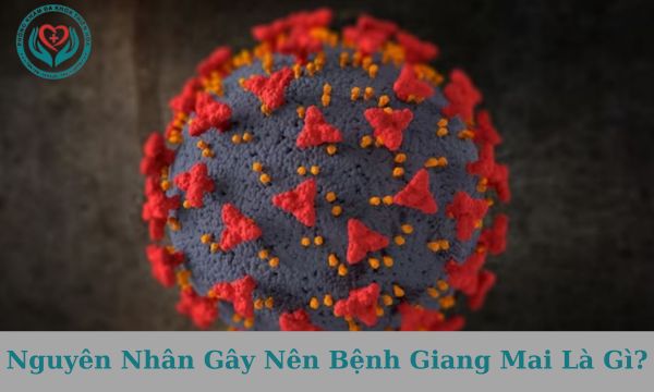 Nguyên nhân gây nên bệnh giang mai